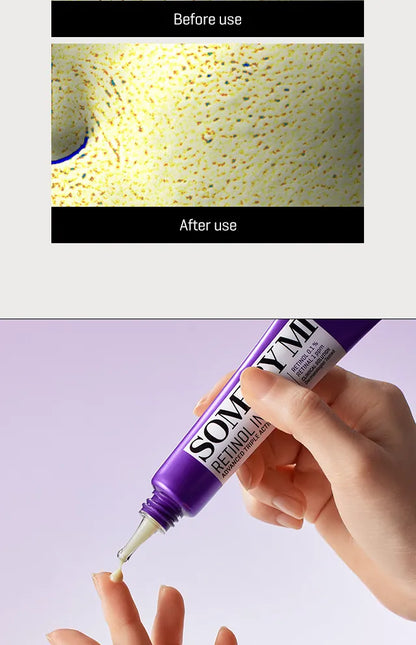 SOME BY MI - Retinol Intense Advanced Triple Action Eye Cream